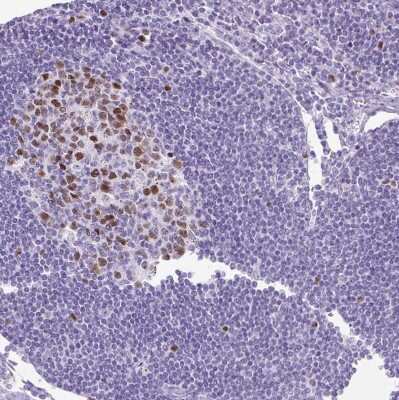 Immunohistochemistry-Paraffin: MgcRacGAP/RACGAP1 Antibody [NBP2-47374]