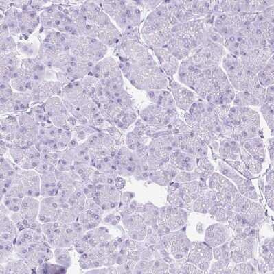 Immunohistochemistry-Paraffin: MgcRacGAP/RACGAP1 Antibody [NBP2-47374]
