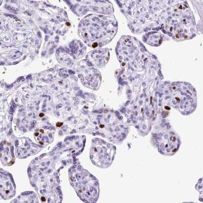 Immunohistochemistry-Paraffin: MgcRacGAP/RACGAP1 Antibody [NBP2-47374]