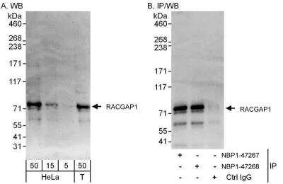 Western Blot: MgcRacGAP/RACGAP1 Antibody [NBP1-47267]