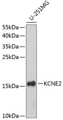 Western Blot: MiRP1 AntibodyBSA Free [NBP3-02949]