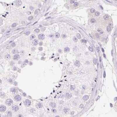 Immunohistochemistry-Paraffin: MiRP1 Antibody [NBP2-38146]