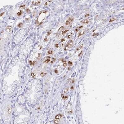 Immunohistochemistry-Paraffin: MiRP1 Antibody [NBP2-38653]