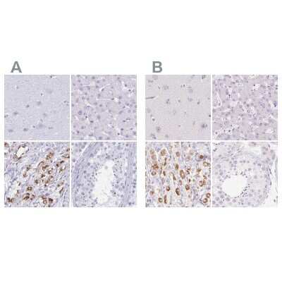 Immunohistochemistry-Paraffin: MiRP1 Antibody [NBP2-38653]