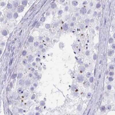 Immunohistochemistry-Paraffin: MiRP1 Antibody [NBP2-38653]