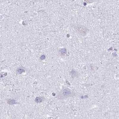 Immunohistochemistry-Paraffin: MiRP1 Antibody [NBP2-38653]