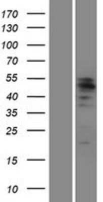 Western Blot: MITF Overexpression Lysate [NBP2-09070]