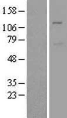 Western Blot: Mind Bomb 1/MIB1 Overexpression Lysate [NBL1-13097]