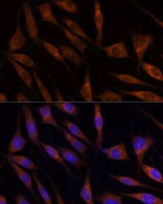 Immunocytochemistry/ Immunofluorescence: Mic1 Antibody - Azide and BSA Free [NBP3-03433]