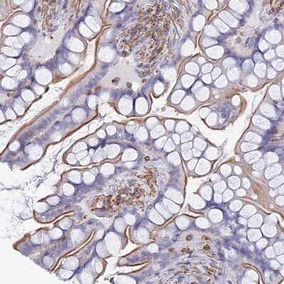 Immunohistochemistry-Paraffin: Mic1 Antibody [NBP2-14389]