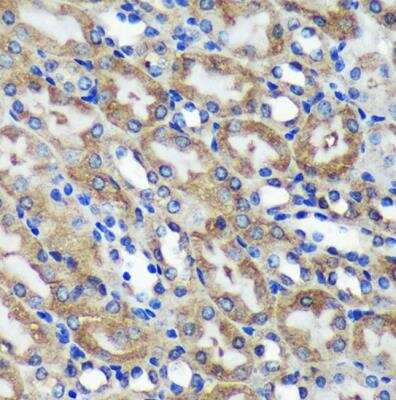 Immunohistochemistry-Paraffin: Mic1 Antibody - Azide and BSA Free [NBP3-03433]