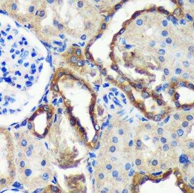 Immunohistochemistry-Paraffin: Mic1 Antibody - Azide and BSA Free [NBP3-03433]