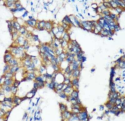 Immunohistochemistry-Paraffin: Mic1 Antibody - Azide and BSA Free [NBP3-03433]