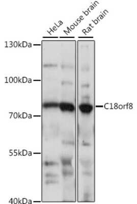 Western Blot: Mic1 AntibodyAzide and BSA Free [NBP3-03433]