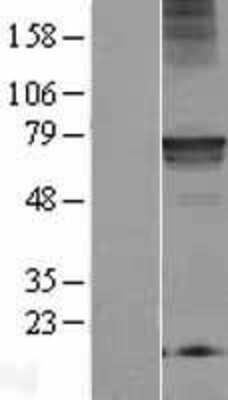 Western Blot: Mic1 Overexpression Lysate [NBL1-08259]