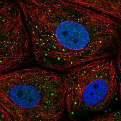 Immunocytochemistry/ Immunofluorescence: Microseminoprotein, Prostate Associated Antibody [NBP2-30630]