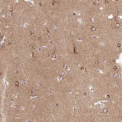 Immunohistochemistry-Paraffin: Microseminoprotein, Prostate Associated Antibody [NBP2-30630]