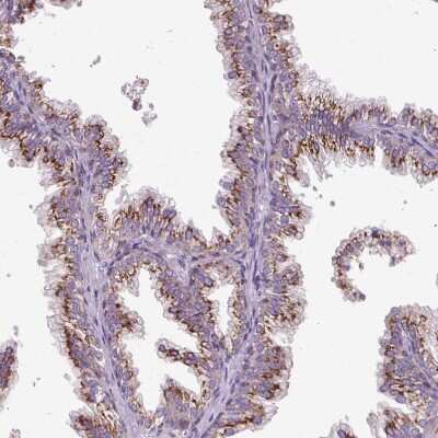 Immunohistochemistry-Paraffin: Microseminoprotein, Prostate Associated Antibody [NBP2-30630]