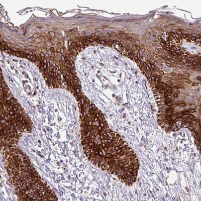 Immunohistochemistry-Paraffin: Microseminoprotein, Prostate Associated Antibody [NBP2-30630]