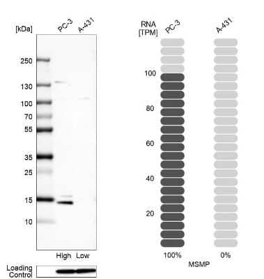 Western Blot: Microseminoprotein, Prostate Associated Antibody [NBP2-30630]