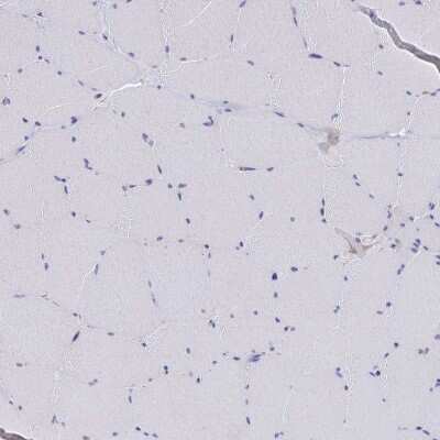 Immunohistochemistry-Paraffin: Microsomal Glutathione S-transferase 1 Antibody [NBP1-92116]