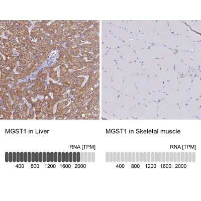 Immunohistochemistry-Paraffin: Microsomal Glutathione S-transferase 1 Antibody [NBP1-92116]