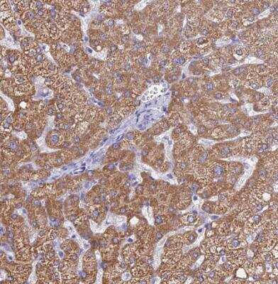 Immunohistochemistry-Paraffin: Microsomal Glutathione S-transferase 1 Antibody [NBP1-92116]