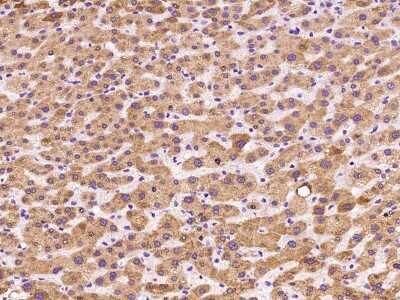 Immunohistochemistry-Paraffin: Microsomal Glutathione S-transferase 1 Antibody [NBP2-97486]