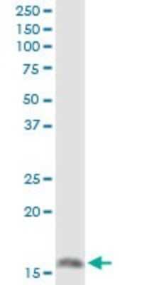 Western Blot: Microsomal Glutathione S-transferase 1 Antibody [H00004257-D01P]