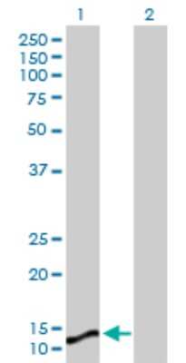 Western Blot: Microsomal Glutathione S-transferase 1 Antibody [H00004257-D01P]