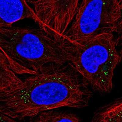 Immunocytochemistry/ Immunofluorescence: Midkine Antibody [NBP2-55458]