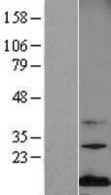 Western Blot: Midkine Overexpression Lysate [NBL1-12968]