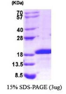 SDS-PAGE: Recombinant Human Midkine His Protein [NBP1-30185]