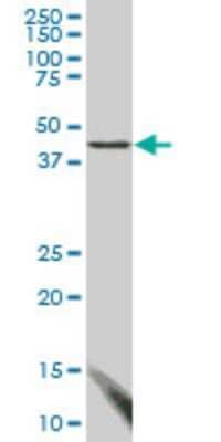 Western Blot: Migfilin Antibody (3F8) [H00054751-M03]