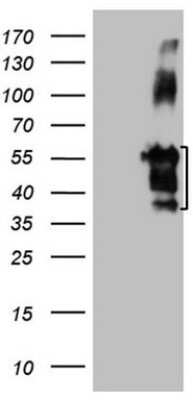 Western Blot: Migfilin Antibody (OTI3G1) [NBP2-45595]