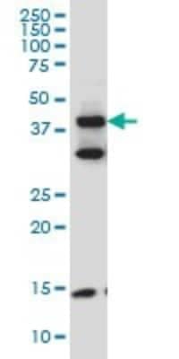 Western Blot: Migfilin Antibody (5E11) [H00054751-M10]