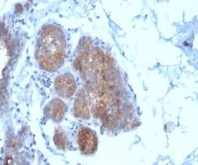 Immunohistochemistry-Paraffin: Migfilin Antibody (FBLIM1/4600) [NBP3-13746]