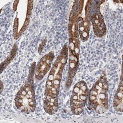 Immunohistochemistry-Paraffin: Migfilin Antibody [NBP1-86665]