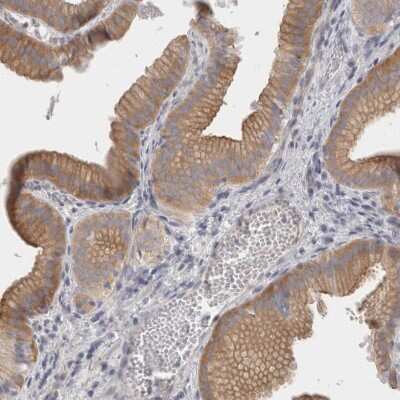 Immunohistochemistry-Paraffin: Migfilin Antibody [NBP1-86665]