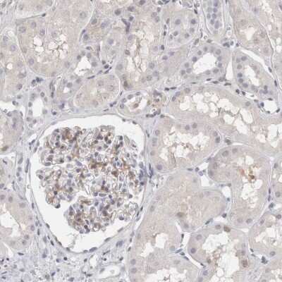 Immunohistochemistry-Paraffin: Migfilin Antibody [NBP1-86665]