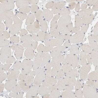 Immunohistochemistry-Paraffin: Migfilin Antibody [NBP1-86665]