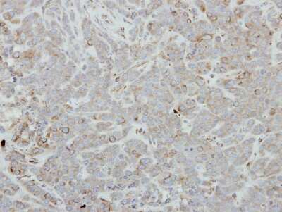 Immunohistochemistry-Paraffin: Migfilin Antibody [NBP2-17291]