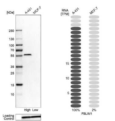 Western Blot: Migfilin Antibody [NBP1-86665]