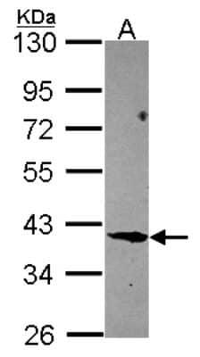 Western Blot: Migfilin Antibody [NBP2-17291]