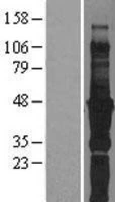 Western Blot: Migfilin Overexpression Lysate [NBL1-10608]