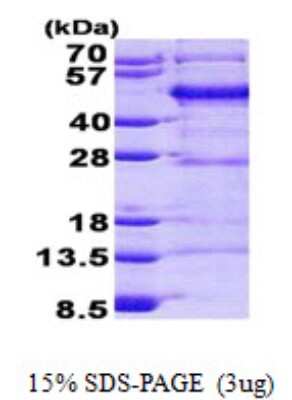 SDS-PAGE: Recombinant Human Migfilin His Protein [NBP2-23053]