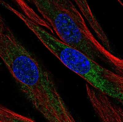 Immunocytochemistry/ Immunofluorescence: Mimecan/OIF Antibody [NBP1-87766]