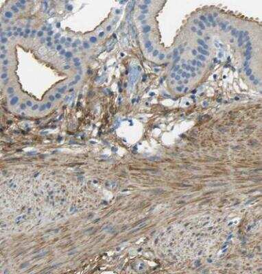 Immunohistochemistry-Paraffin: Mimecan/OIF Antibody [NBP1-87766]