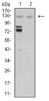 Western Blot: Mind Bomb 1/MIB1 Antibody (2A7B1)BSA Free [NBP2-61865]