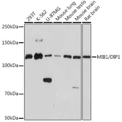 Western Blot: Mind Bomb 1/MIB1 Antibody (9Q4N9) [NBP3-16175]